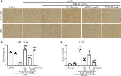 Antifibrotic Effect of a Novel Selective 11β-HSD2 Inhibitor (WZ51) in a rat Model of Myocardial Fibrosis